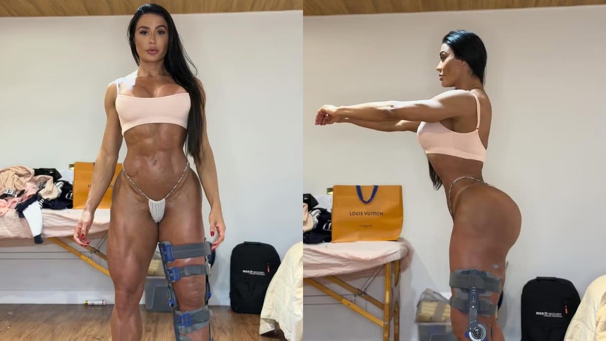 Gracyanne Barbosa exibe o corpo após lesão no 'Dança dos Famosos'