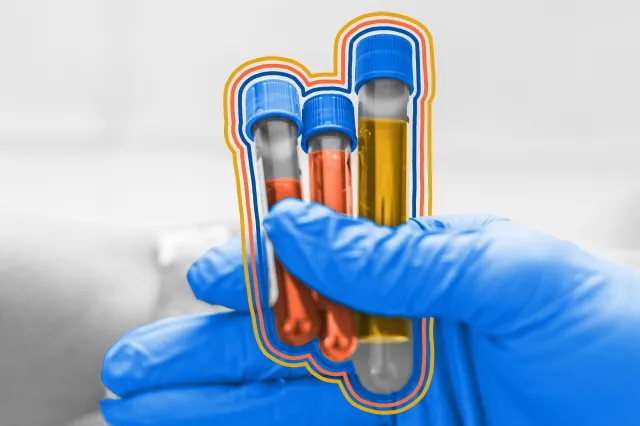 Frascos de teste de sangue para grupos sanguíneos segurados por enfermeira